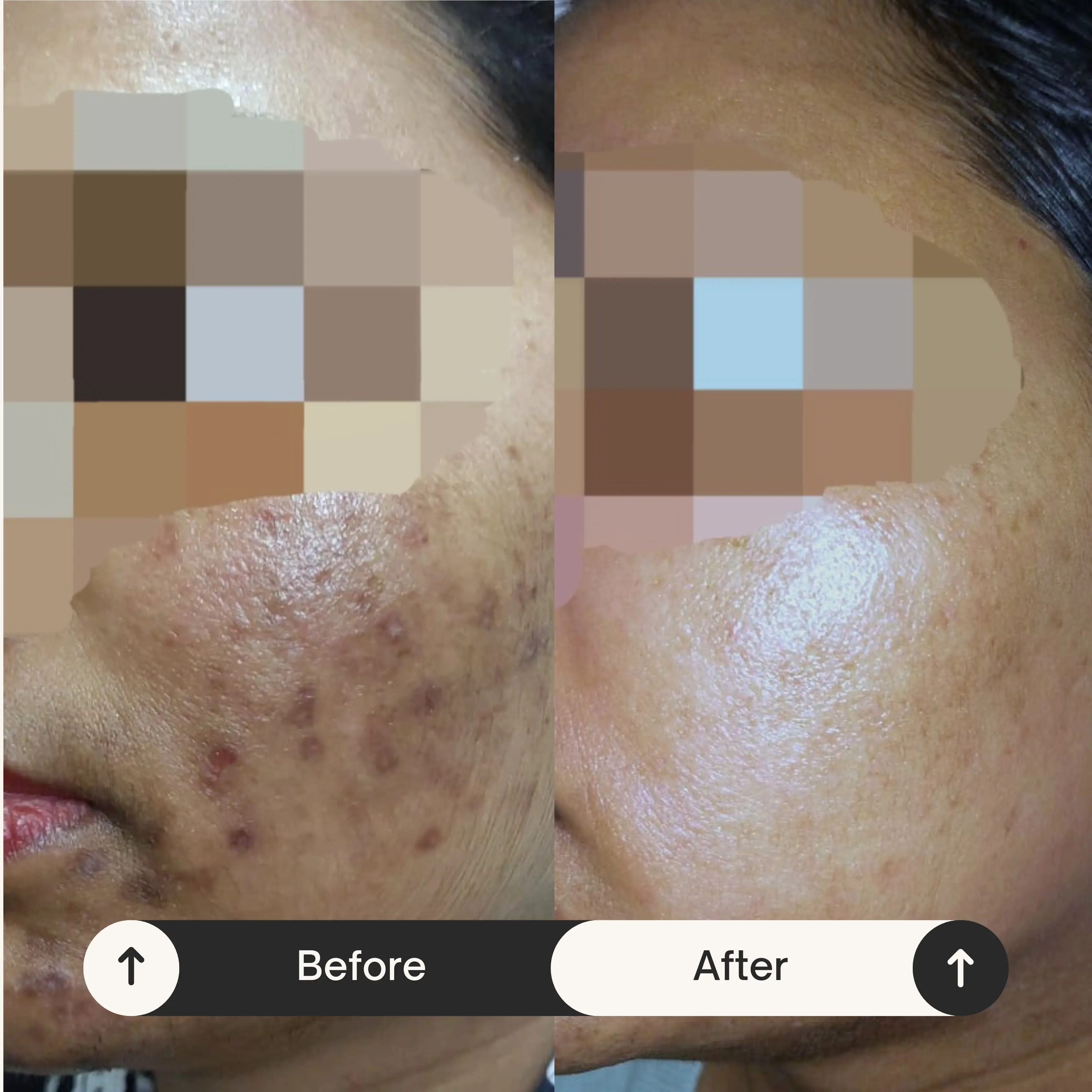 Skin Treatment Result