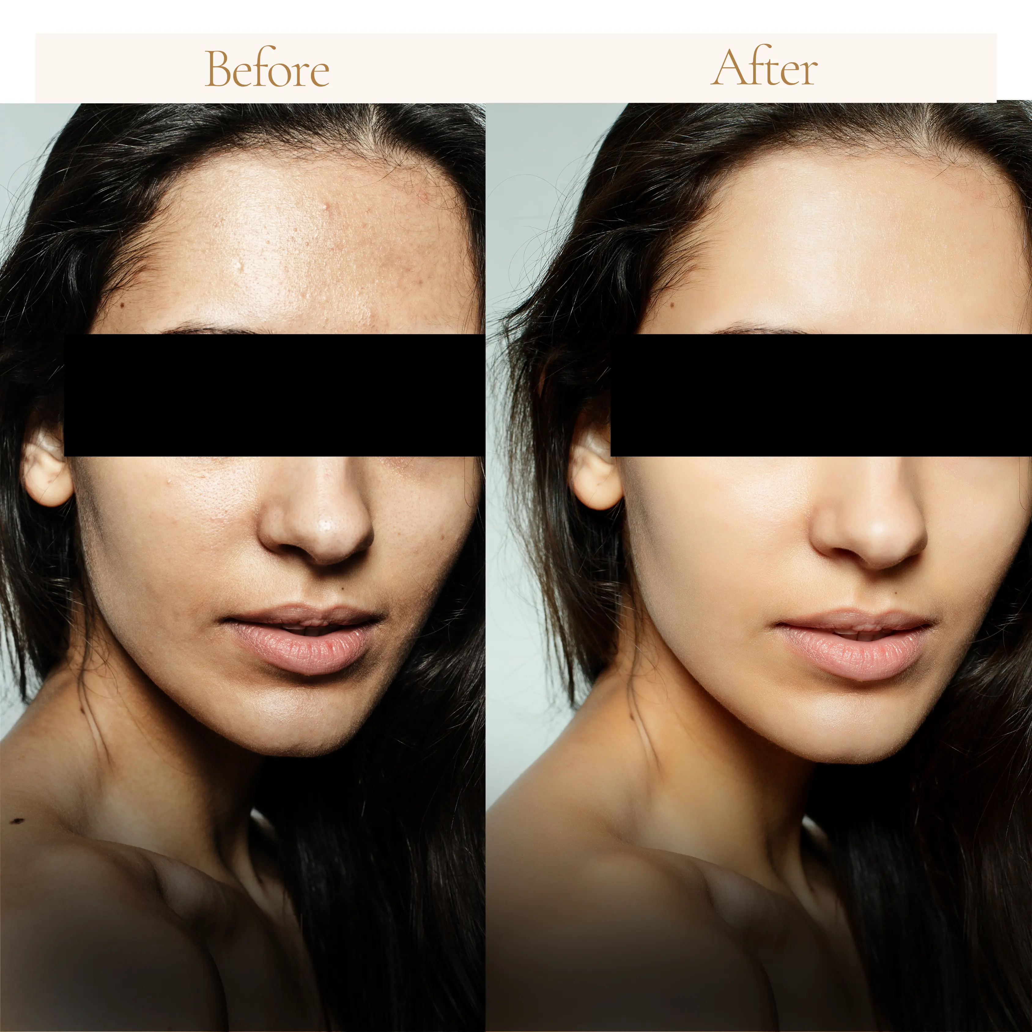 Skin Treatment Result