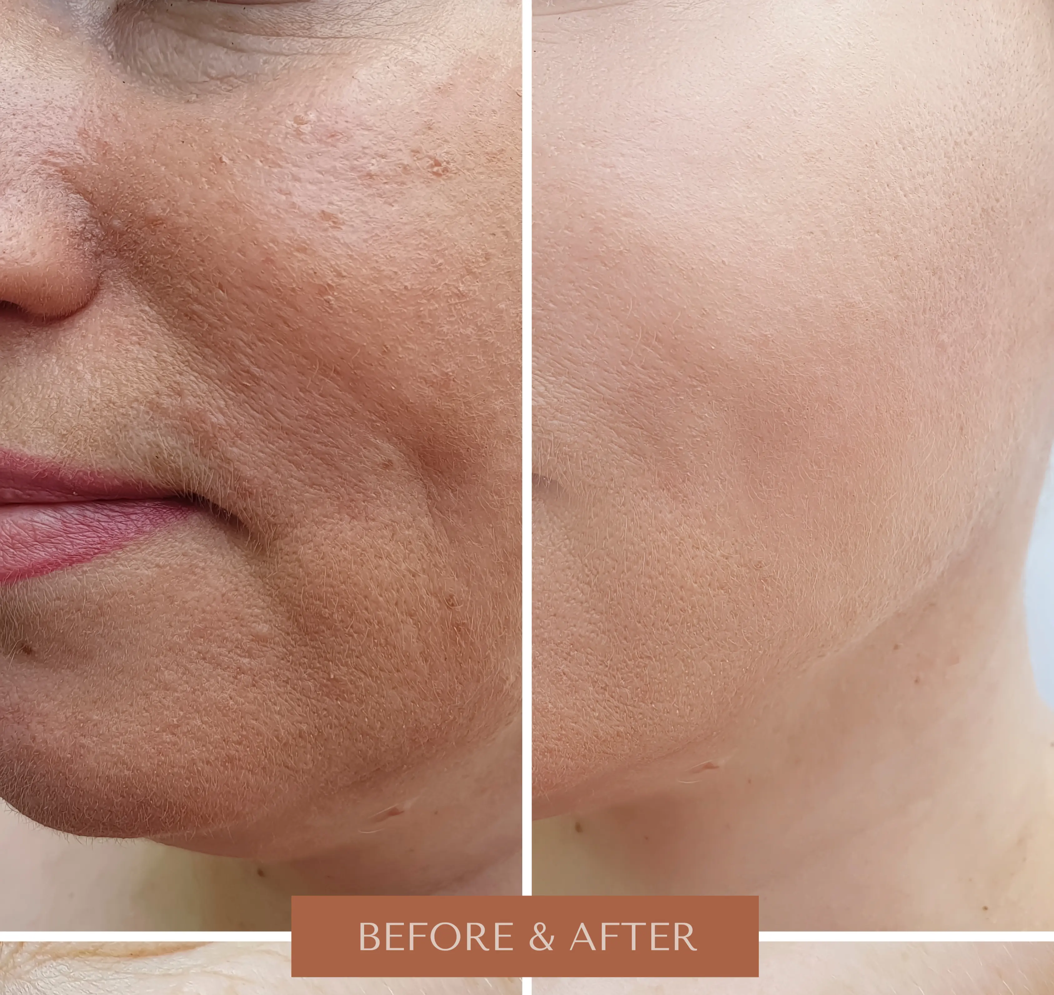 Anti-Aging Transformation