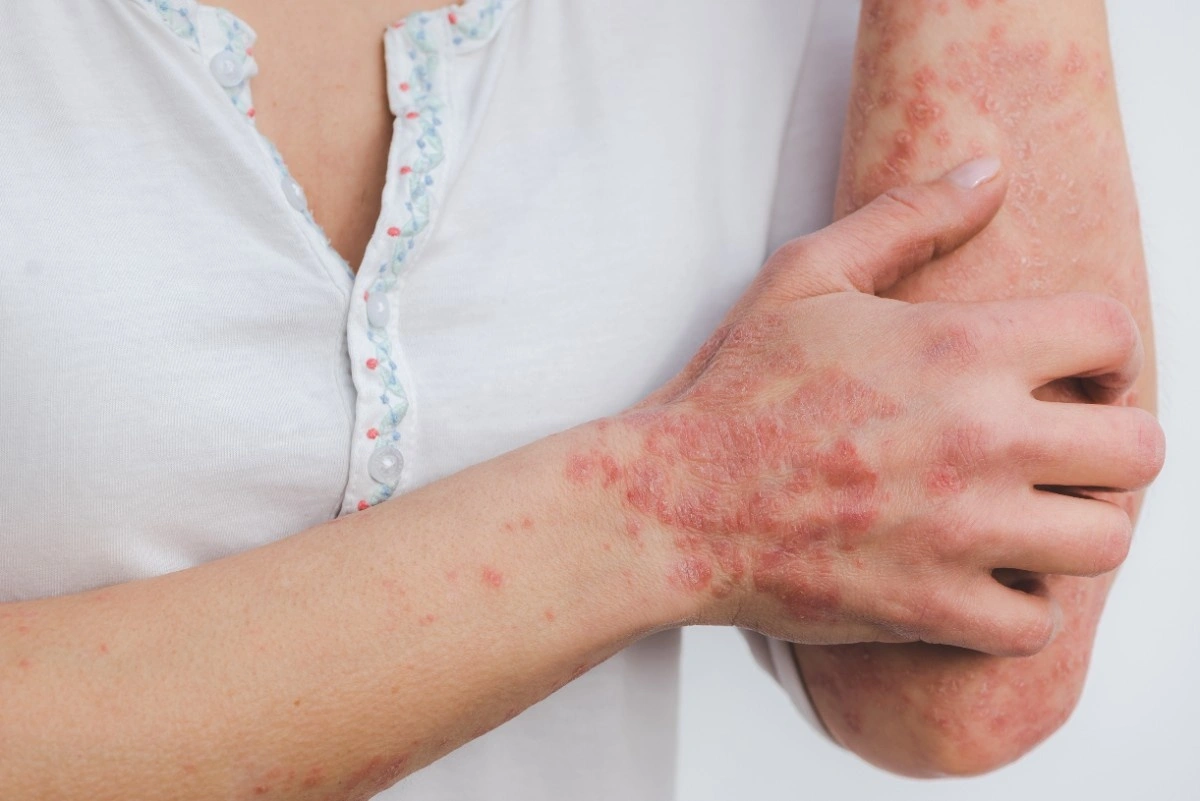Homeopathic Consultation